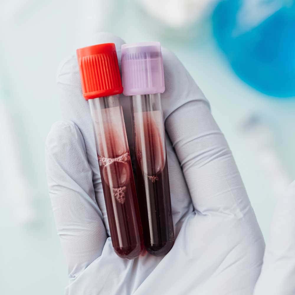 World Blood Cancer Day: A Fight for Life and Hope | De Último Minuto English
