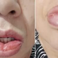 They will stop manufacturing a well-known toothpaste after thousands of complaints about adverse reactions | De Último Minuto English