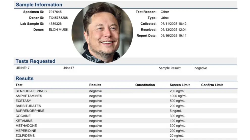 Elon Musk shares a urine analysis with negative drug test results | De Último Minuto English