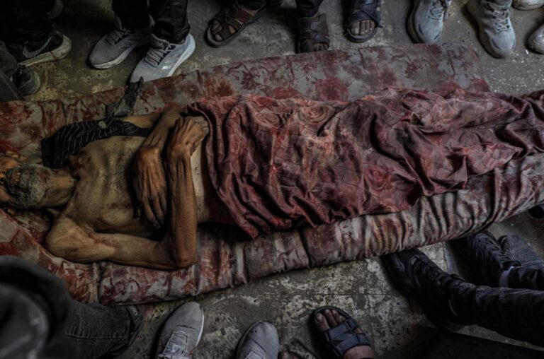 At least 86 Gazans killed on Wednesday while seeking humanitarian aid | 7 | At least 86 Gazans killed on Wednesday while seeking humanitarian aid | De Último Minuto English