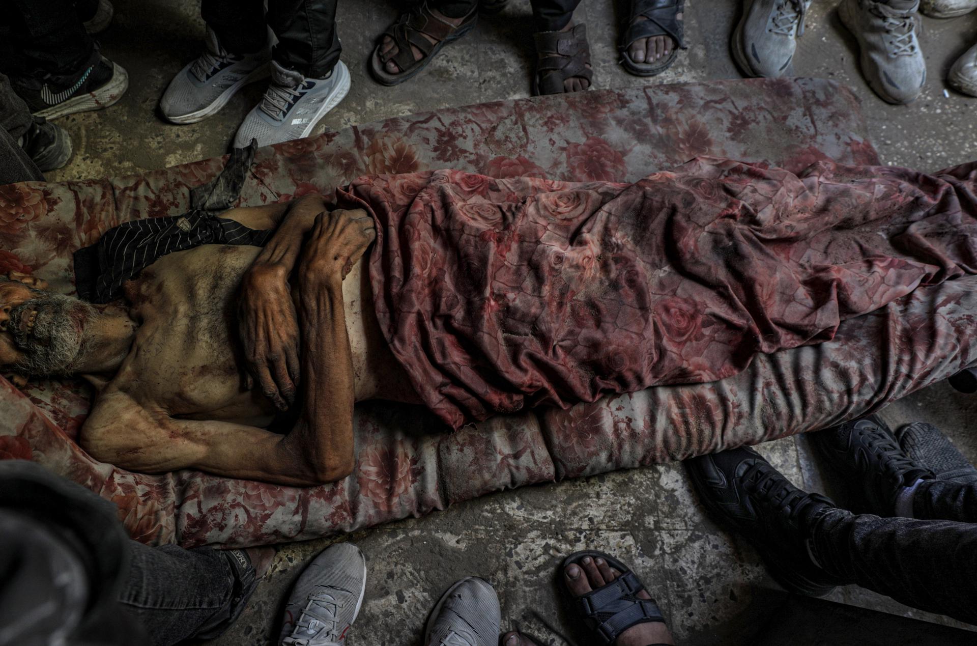 At least 86 Gazans killed on Wednesday while seeking humanitarian aid | De Último Minuto English