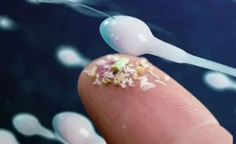 Microplastics detected in human reproductive fluids: a possible threat to fertility | De Último Minuto English