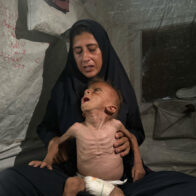 Sick and malnourished, the children of Gaza that Israel calls 'fake news' are also starving. | De Último Minuto English