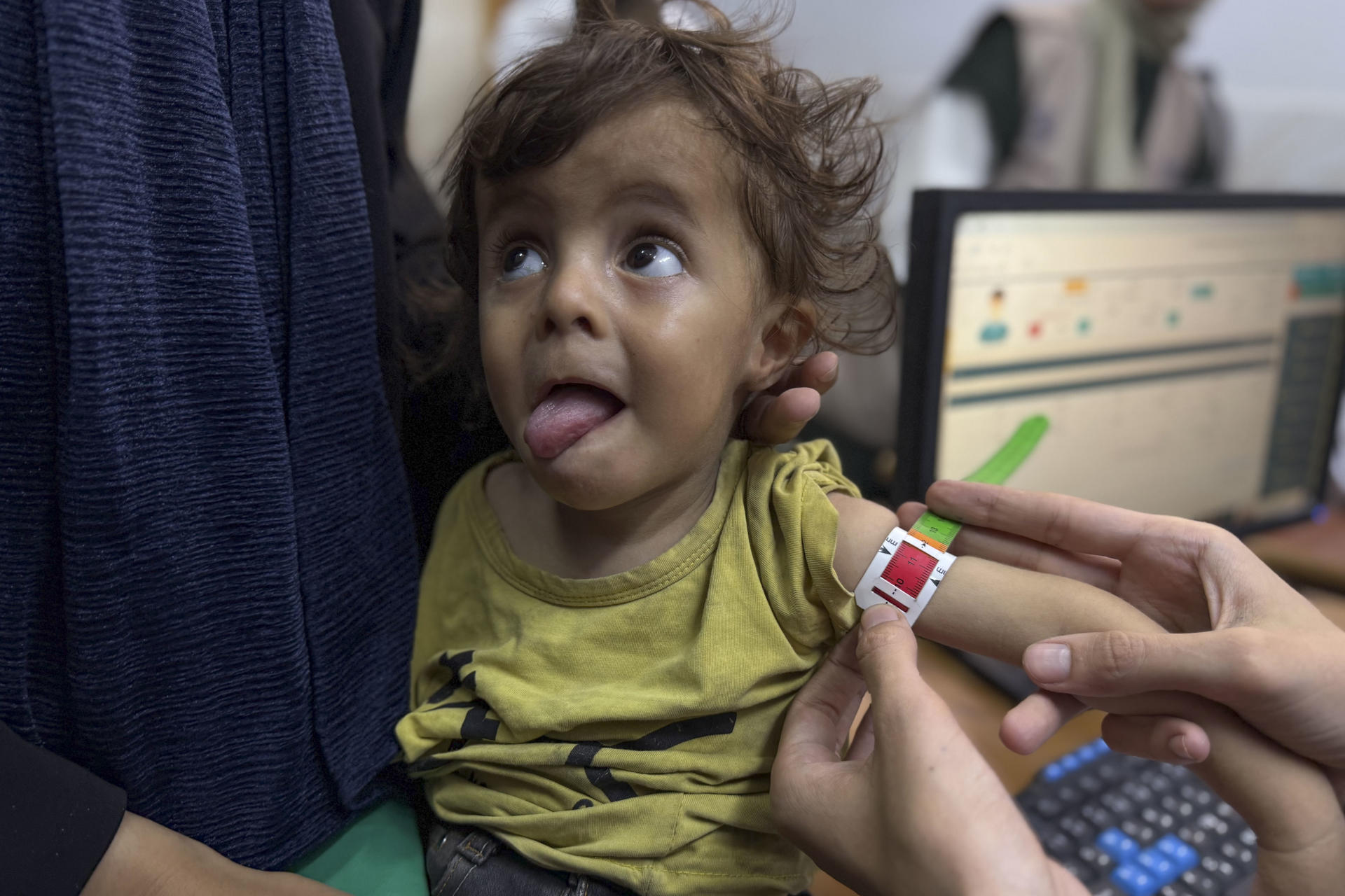 Two people died of hunger in Gaza yesterday, bringing the total to 271, according to the Ministry of Health | De Último Minuto English