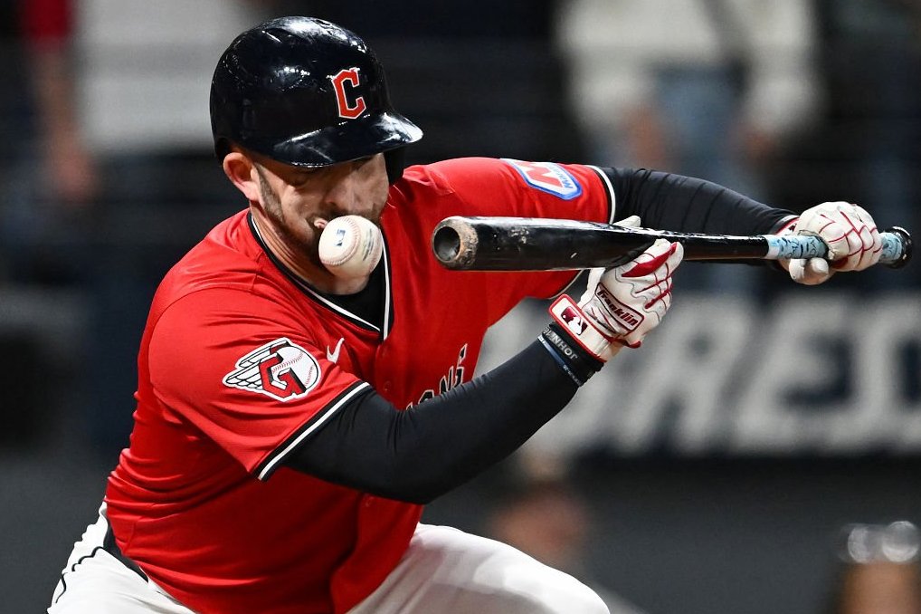 David Fry exits the game after being hit in the face by a pitch in the Guardians' victory over the Tigers | De Último Minuto English