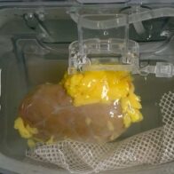 Scientists create a 'universal' kidney compatible with any patient | De Último Minuto English