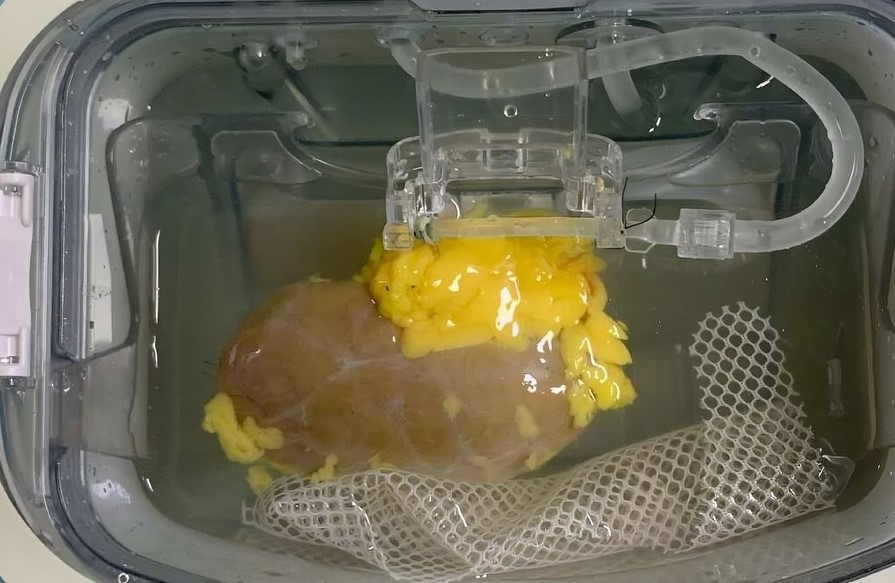 Scientists create a 'universal' kidney compatible with any patient | De Último Minuto English