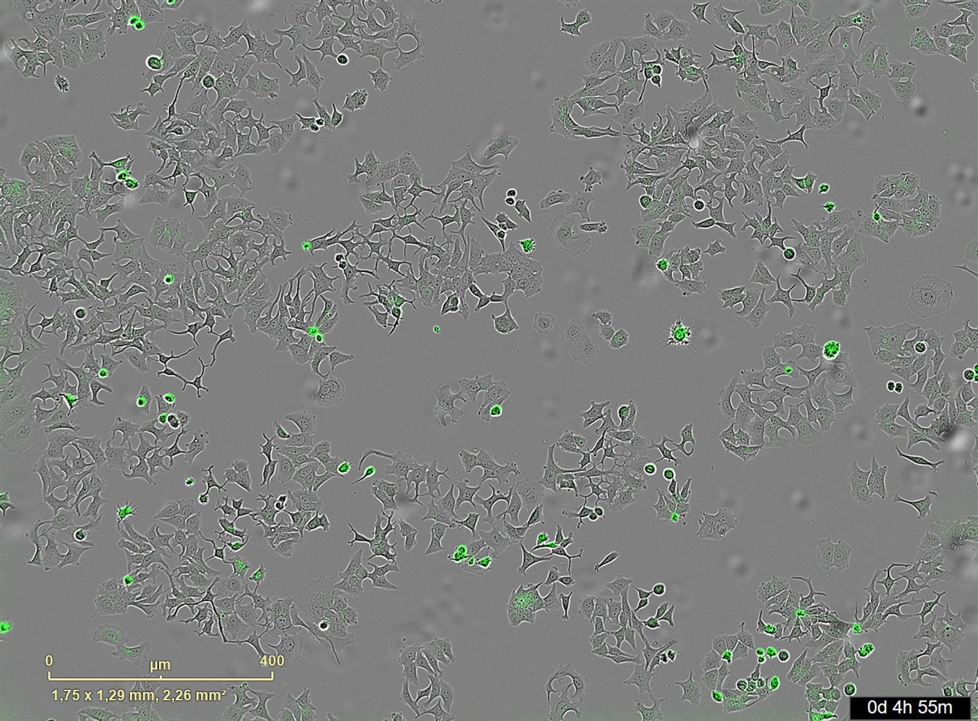 They discover a bacterial mechanism that could destroy tumor cells | De Último Minuto English