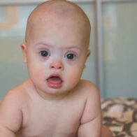 They describe how Down syndrome alters brain development before birth | De Último Minuto English