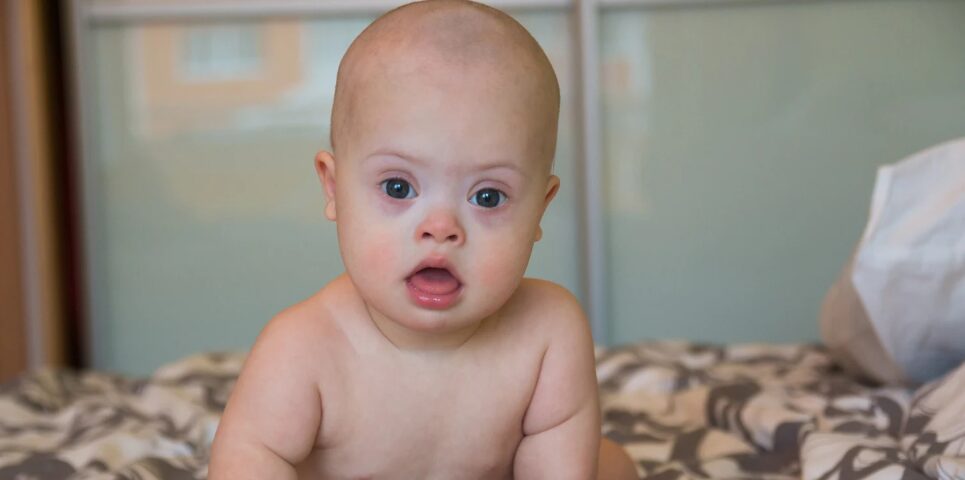 They describe how Down syndrome alters brain development before birth | De Último Minuto English