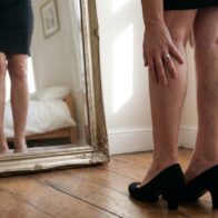Varicose veins: the home remedy with apple cider vinegar that improves the appearance of your legs | De Último Minuto English