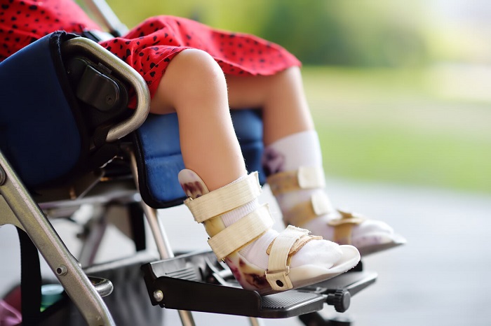 "Patients with Spinal Muscular Atrophy demand urgent access to treatments" | De Último Minuto English