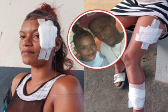 Young woman reports savage machete attack by her ex-partner despite five arrest warrants in Santiago | De Último Minuto English