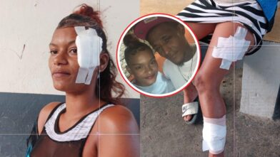 Young woman reports savage machete attack by her ex-partner despite five arrest warrants in Santiago | De Último Minuto English