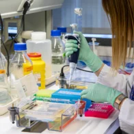 WHO: More than 90% of the world's population will be affected by cancer in some way | De Último Minuto English
