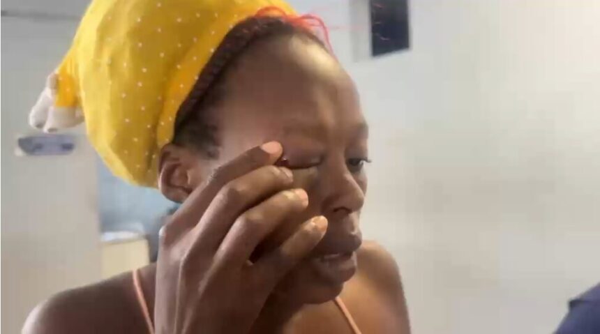 Man assaults his Haitian ex-partner and causes facial injuries in San Francisco de Macorís | De Último Minuto English