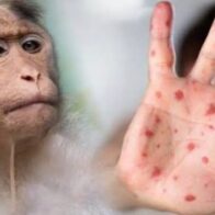 Costa Rica detects two cases of monkeypox and activates surveillance protocols | De Último Minuto English