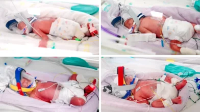 Rare identical quadruplets born in Australia after natural conception