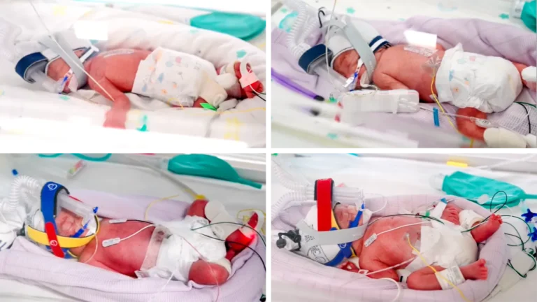 Rare identical quadruplets born in Australia after natural conception