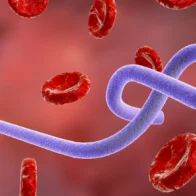 The WHO warns that Ebola is spreading in the DRC and its "true magnitude" is unknown | De Último Minuto English