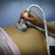 Chilean far-right seeks to force women to hear the fetal heartbeat before having an abortion | De Último Minuto English