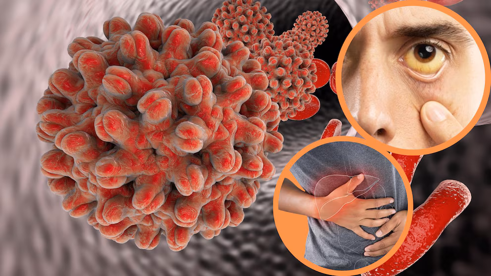 Costa Rica confirms 14 cases of hepatitis A and contamination in water system | De Último Minuto English