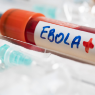 Ebola epidemic covers a territory larger than France and where there is no liquidity | De Último Minuto English