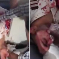 Images show bloodied people after incident on Flydubai flight | De Último Minuto English