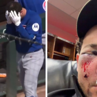 Bregman awaiting test results after being hit in face by foul ball while in on-deck circle