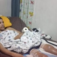 Family seeks help for 30-year-old Dominican man with rare disease | De Último Minuto English