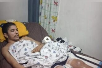 Family seeks help for 30-year-old Dominican man with rare disease | De Último Minuto English