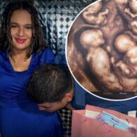 Colombian woman reaches 30 weeks pregnant with rare identical quadruplets | De Último Minuto English