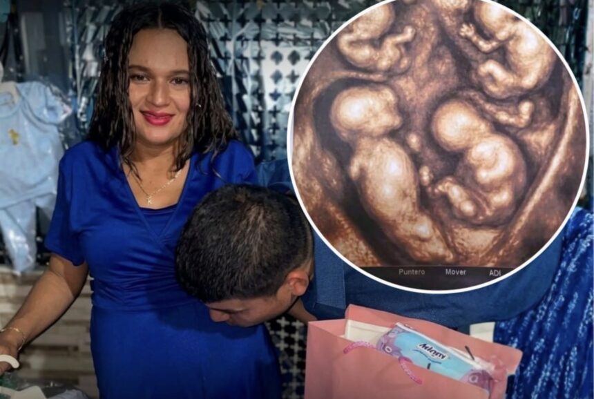 Colombian woman reaches 30 weeks pregnant with rare identical quadruplets | De Último Minuto English