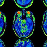 Scientists develop AI model designed to reconstruct images from brain activity | De Último Minuto English