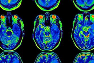 Scientists develop AI model designed to reconstruct images from brain activity | De Último Minuto English