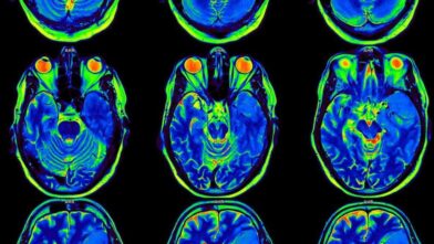 Scientists develop AI model designed to reconstruct images from brain activity | De Último Minuto English