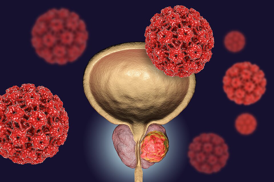 Oxford scientists identify blood proteins linked to prostate cancer risk up to 15 years before diagnosis