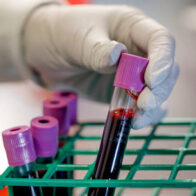 Russia registers drug developed to treat aggressive breast and ovarian cancers