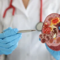 How to protect your kidneys: nephrologist recommends less salt and moderate meat intake