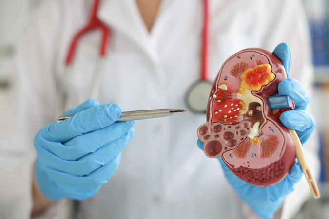 How to protect your kidneys: nephrologist recommends less salt and moderate meat intake