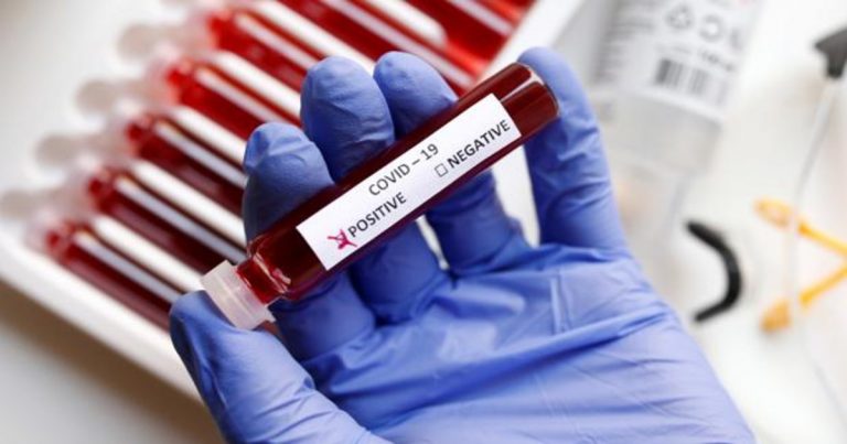 coronavirus positivo2 k7sF 1200x630@abc | Noticias de hoy en De Último Minuto
