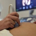 Corte Suprema de México declara inconstitucional penalizar el aborto