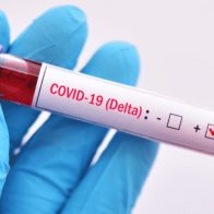 Variante delta del coronavirus circula en todo el territorio dominicano