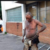 Fallece hombre se prendió fuego frente a fiscalía del Distrito Nacional