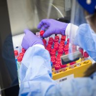 Reportan 422 nuevos contagios de covid-19 y 4 decesos