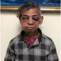 Policía investiga identidad y paradero hombres que golpearon a “Fracatira” en Santiago