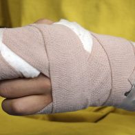 Apresan a mujer que quemó en una estufa ambas manos a hijo de seis años