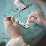 Brasil confirma el primer caso de la la subvariante ómicron XE