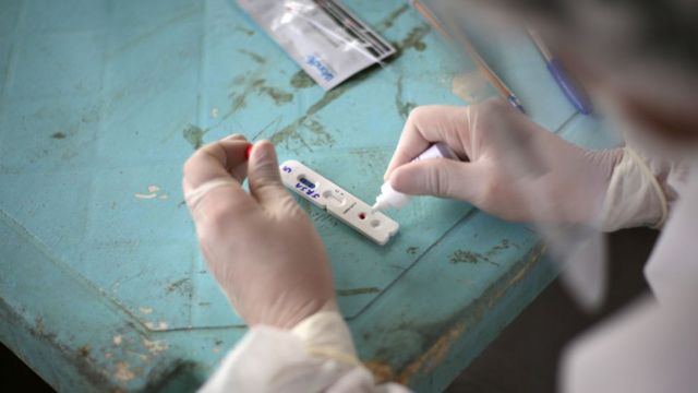 Brasil confirma el primer caso de la la subvariante ómicron XE