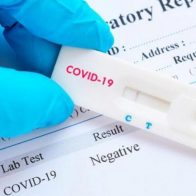 Notifican 39 nuevos contagios Covid y ninguna defunción